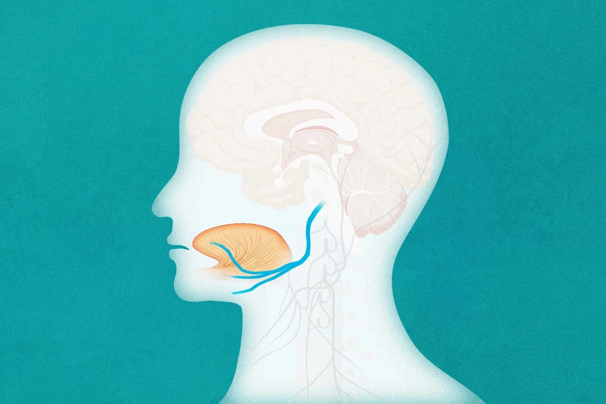 La estimulación del nervio hipogloso podría aliviar la apnea del sueño. (Ilustración de The Epoch Times, Shutterstock).