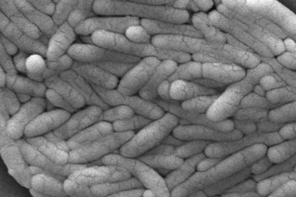 CDC alerta: Brote de salmonela en niños por camaleones domésticos