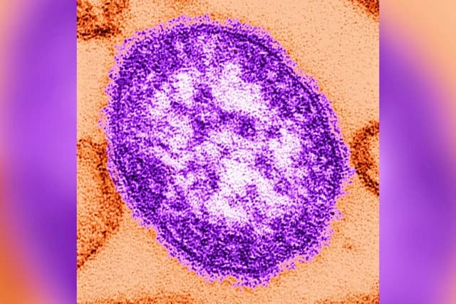 Una micrografía electrónica de transmisión (TEM) de sección delgada revela la apariencia ultraestructural de una sola partícula viral, o “virión”, del virus del sarampión. (CDC a través de Getty Images).