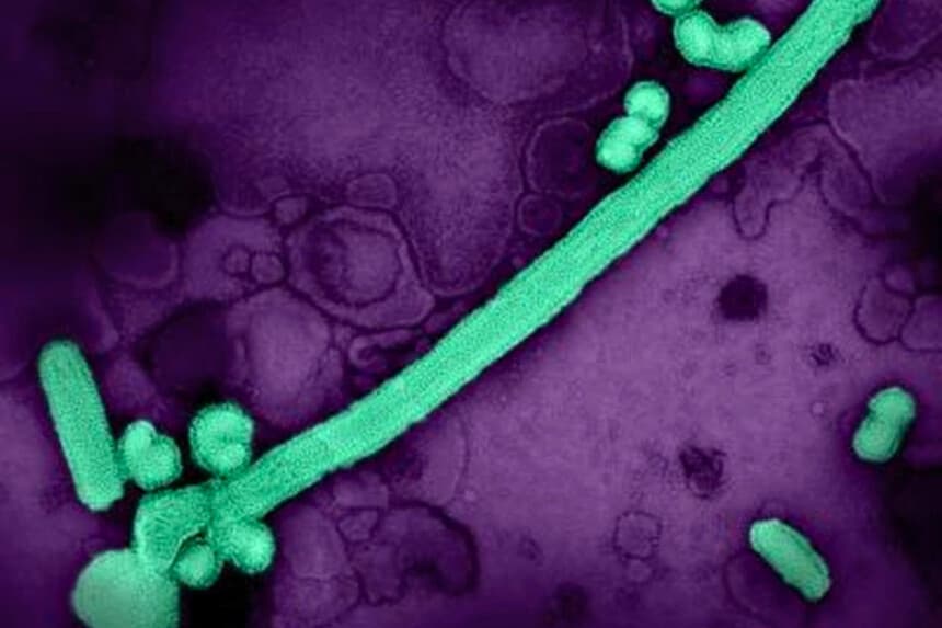 Una imagen coloreada tomada con microscopio electrónico muestra partículas del virus de la gripe A aisladas de una muestra de un paciente y cultivadas en un cultivo celular. Instituto Nacional de Alergias y Enfermedades Infecciosas, vía The Epoch Times