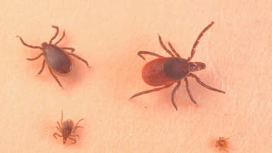 1 de cada 4 personas en ciertos estados de EE. UU. tendría alergia a la carne por garrapatas: CDC
