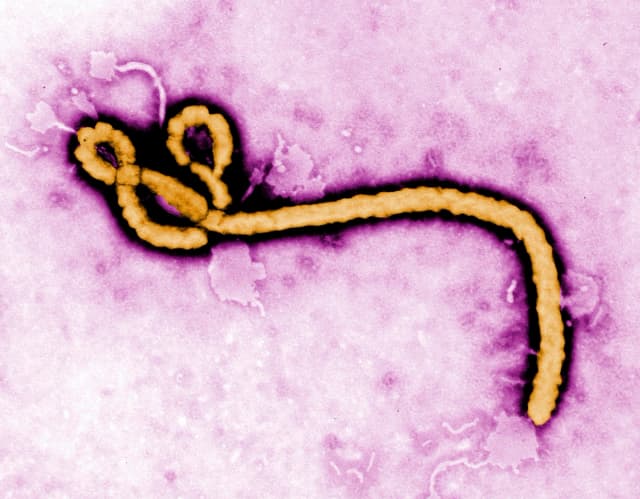 Esta micrografía electrónica de transmisión coloreada, sin fecha, proporcionada por los Centros para el Control y la Prevención de Enfermedades (CDC), muestra un virión del virus del Ébola. (Frederick Murphy/CDC vía AP, Archivo)