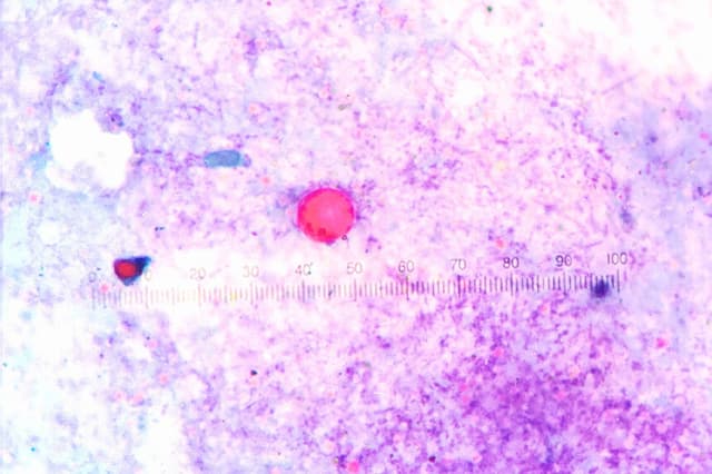 Un ooquiste de Cyclospora en las heces. (phiraporn takham/Shutterstock).