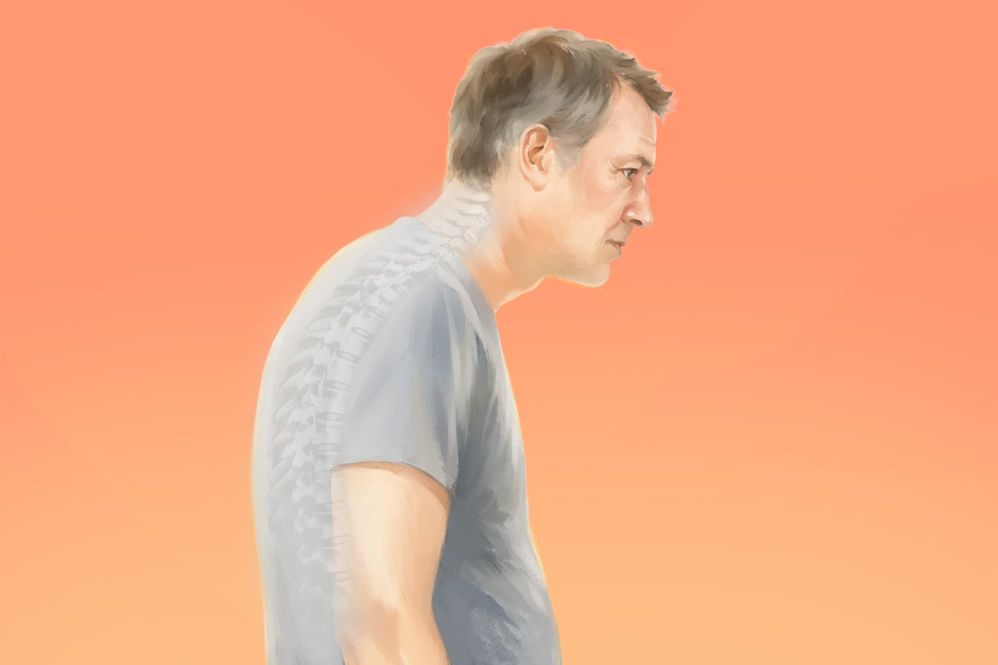 Joroba: La curvatura natural de la columna se vuelve anormal: así es como se puede revertir. (Ilustración de The Epoch Times).