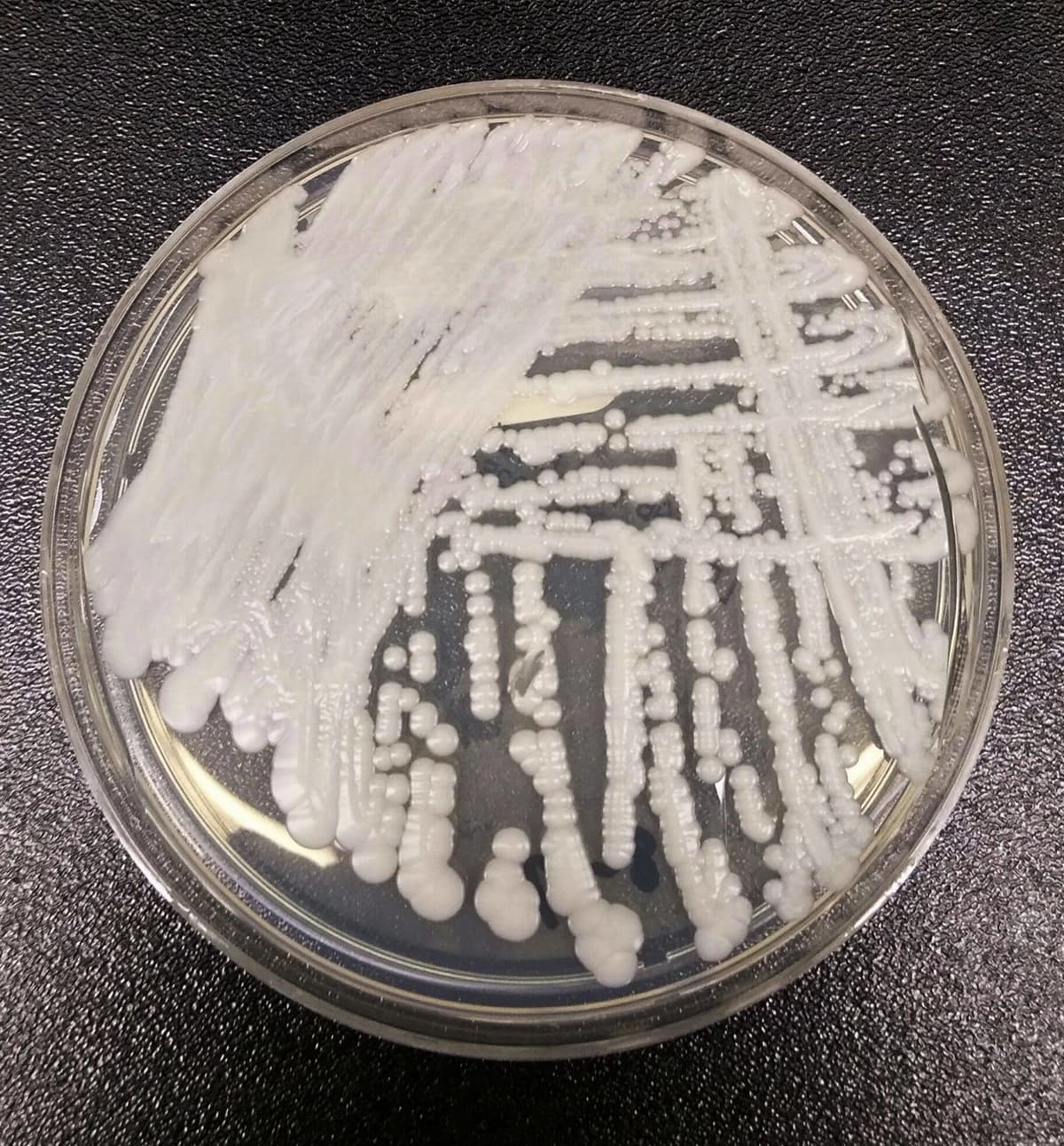 Esta foto sin fecha, proporcionada por los Centros para el Control y la Prevención de Enfermedades (CDC), muestra una cepa de Candida auris cultivada en una placa de Petri en un laboratorio de los CDC. (The Canadian Press/Shawn Lockhart-CDC vía AP)