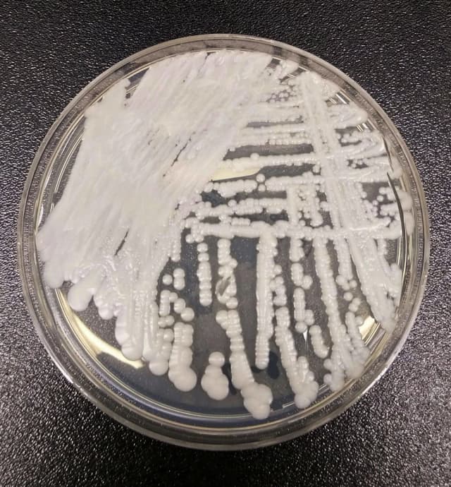 Esta foto sin fecha, proporcionada por los Centros para el Control y la Prevención de Enfermedades (CDC), muestra una cepa de Candida auris cultivada en una placa de Petri en un laboratorio de los CDC. (The Canadian Press/Shawn Lockhart-CDC vía AP)