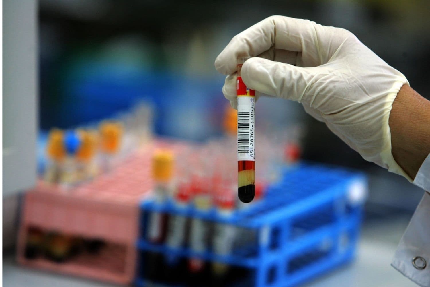 Empresa de biotecnología despide a casi todo su personal tras dos muertes de pacientes
